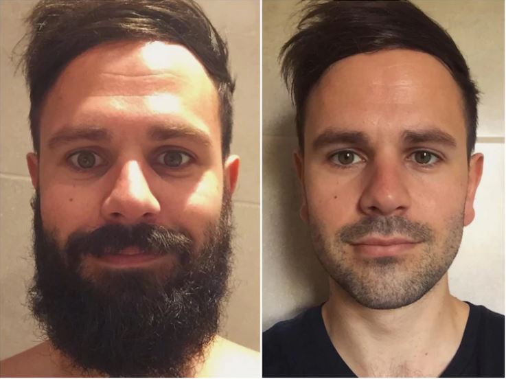 Брить по росту. Отращивание бороды. Усы до и после. Растительность на лице у мужчин. Мужик с бородой и без.
