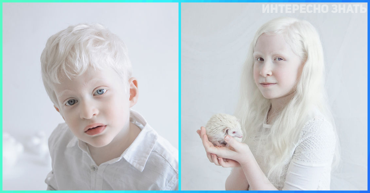 Альбиносы люди и животные фото
