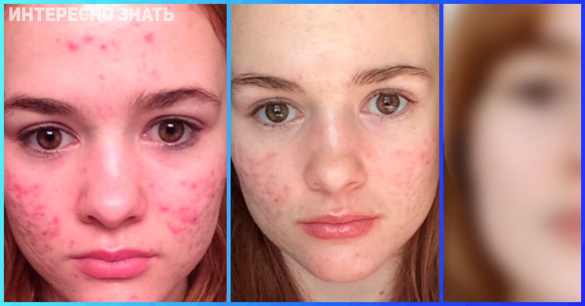 Faceapp Vs Facetune treeox