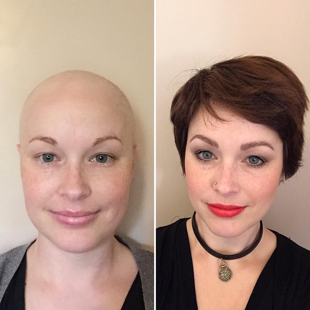 Можно ли победить рак. Макияж после химиотерапии. Брови после химиотерапии. Перманентный макияж до и после.