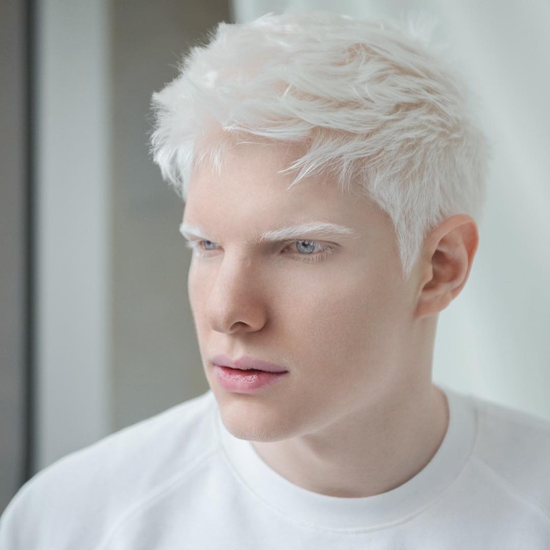 негр и азиат альбинос фото 96