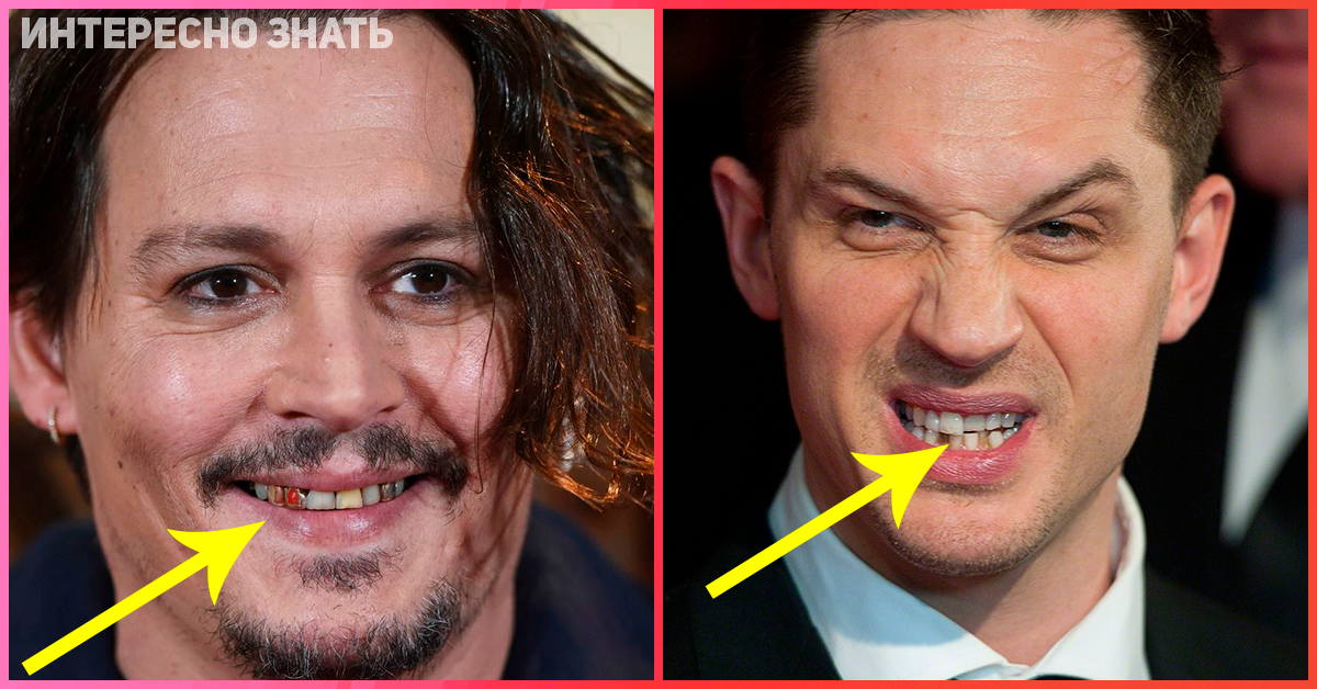 Том харди улыбка зубы фото до и после