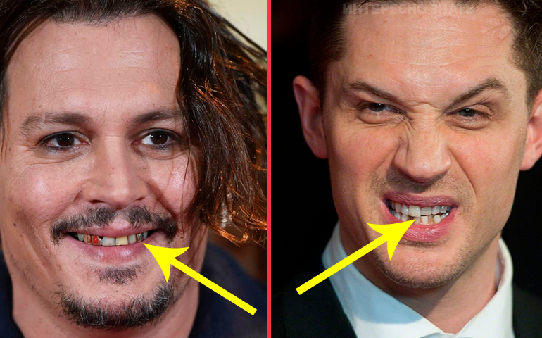Не голливудская улыбка: кто из звёзд исправил прикус и кривые зубы?