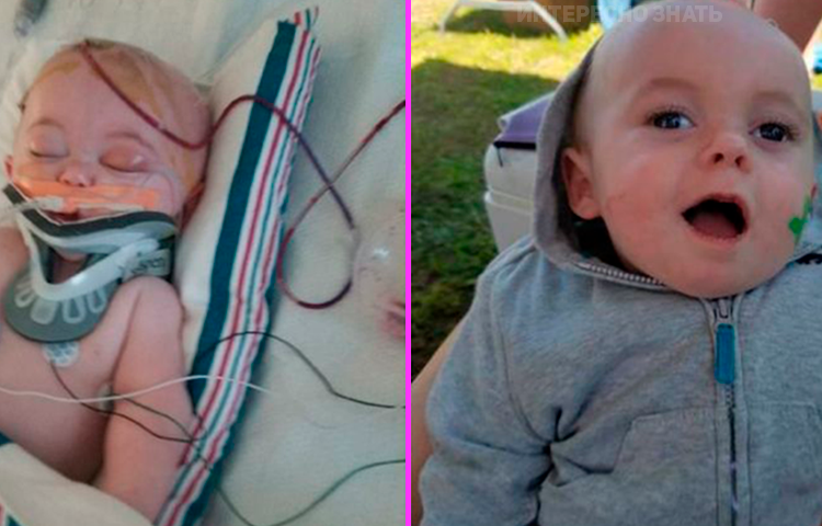 Ребенок 7 месяцев упал с кровати головой затылком